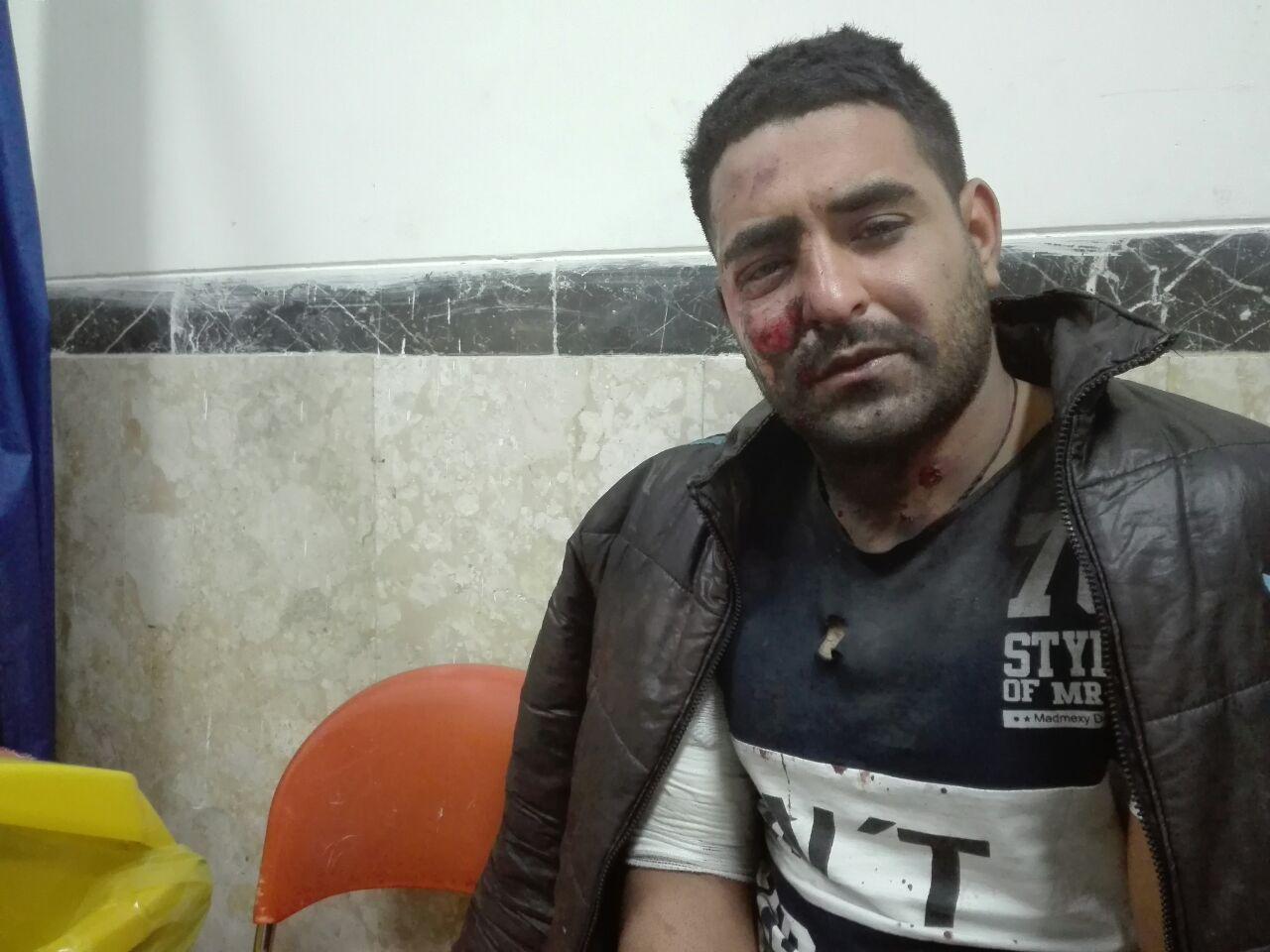 ۶۳ مجروح تازه‌ترین آمار مصدومان چهارشنبه سوری درکرمانشاه