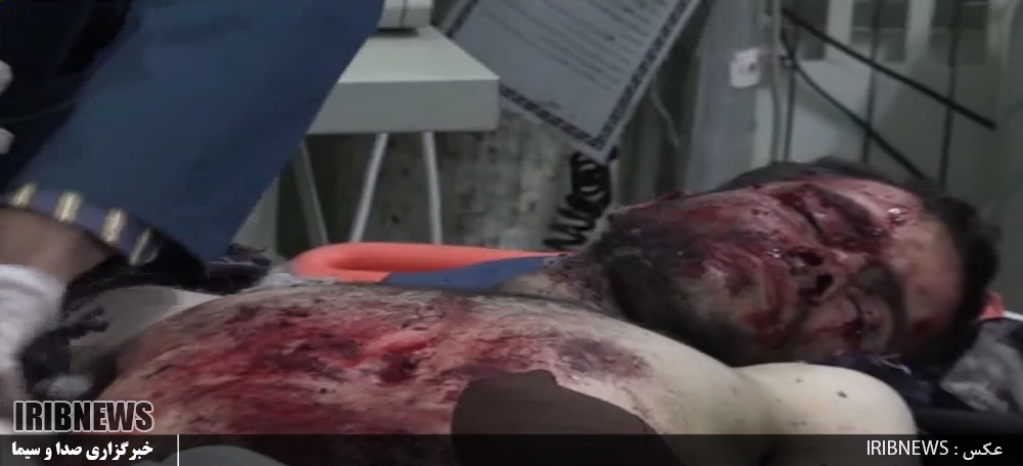 138 نفر مصدوم و یک نفر فوتی حاصل بی احتیاطی چهارشنبه سوری آخر سال اردبیل