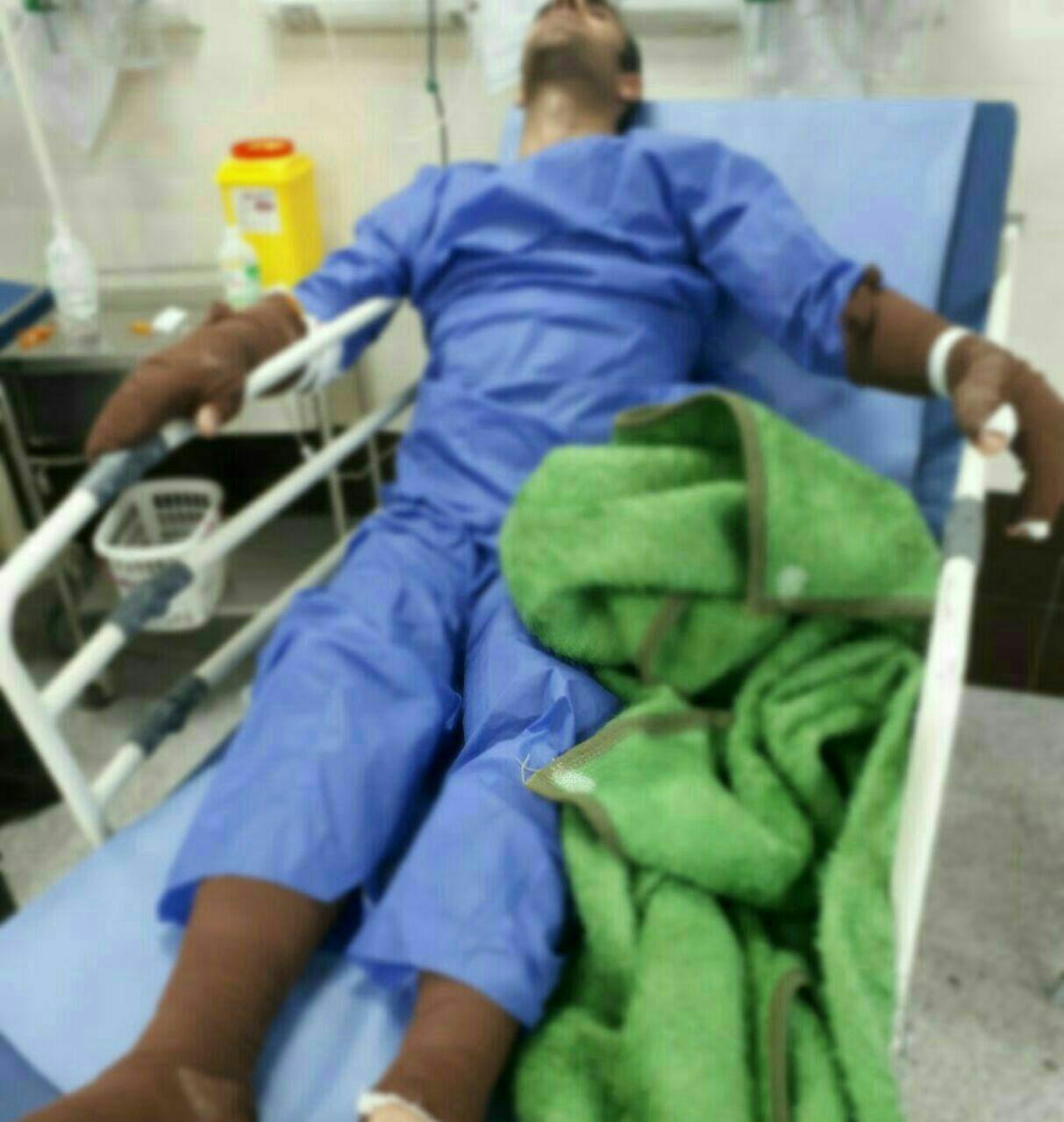 سوختگی مرد جوان با اسید در شهرک‌ صنعتی لیا