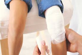 مبتلایان به هموفیلی هم خون میخواهند هم مهربانی!///لطفا منتشر نشود درحال تکمیل مبتلایان به هموفیلی هم خون میخواهند هم مهربانی!///لطفا منتشر نشود درحال تکمیل