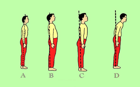 گرفتاری 80 درصد دانش آموزان خراسان رضوی به ناهنجاری ساختارقامتی