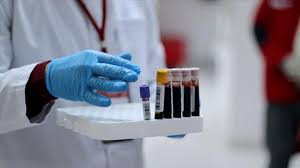 لزوم رعایت فاصله گذاری اجتماعی