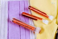 افزايش شاخص سرایت کرونا در آلمان افزايش شاخص سرایت کرونا در آلمان