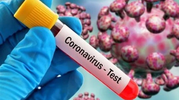 سهم عوامل مرتبط با ابتلا به کرونا چقدر است؟ سهم عوامل مرتبط با ابتلا به کرونا چقدر است؟