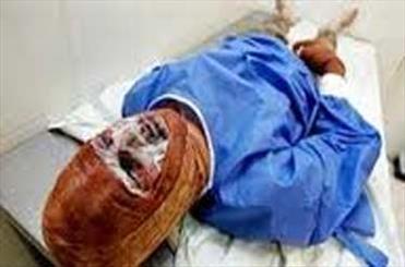 افزایش ۱۷ درصدی تلفات ناشی از سوختگی در آذربایجان شرقی