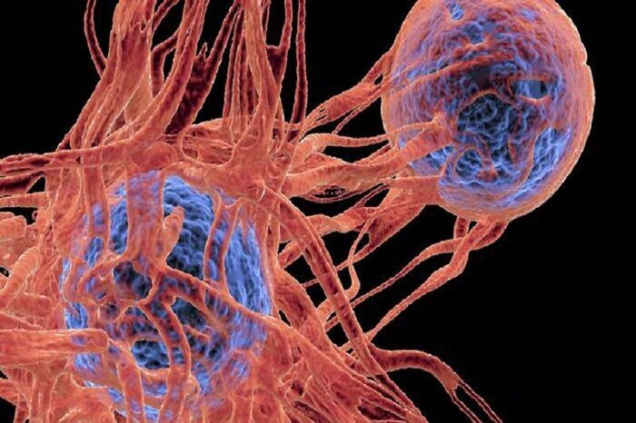 سرطان معده، سینه و پروستات سه سرطان شایع در اردبیل