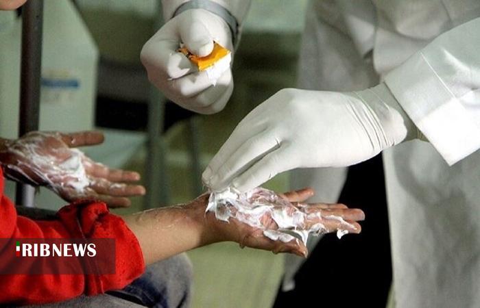 افزایش مصدومان چهارشنبه سوری لرستان به ۳۱ نفر