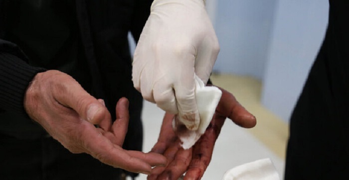 حوادث چهارشنبه سوری در آذربایجان غربی ۵۴۲ مصدوم داشت حوادث چهارشنبه سوری در آذربایجان غربی ۵۴۲ مصدوم داشت